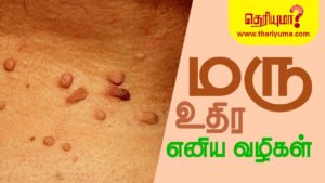 warts maru in english types of warts warts on face massa on skin in english how to remove warts
