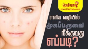 ace pimples remove tips in tamil how to remove pimples in tamil how to remove pimples naturally and permanently how to remove pimples doctor advice in tamil how to remove pimples in forehead in tamil pimple cure tips how to prevent pimples on face forever types of pimples on face Load Metrics (uses 6 credits) KEYWORD face pimples remove tips in tamil how to remove pimples in tamil pimple cure tips how to remove pimples doctor advice in tamil how to remove pimples naturally and permanently how to remove pimples in forehead in tamil how to remove pimples in tamil face skin care tips types of pimples on face how to prevent pimples on face forever causes of pimples on face in adults acne types how to remove pimples in tamil face skin care tips types of pimples on face how to prevent pimples on face forever causes of pimples on face in adults acne types acne meaning acne treatment